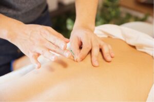 Acupunctuur, voor een soepele rug en meer bewegingsvrijheid