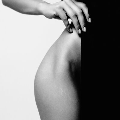 Striae